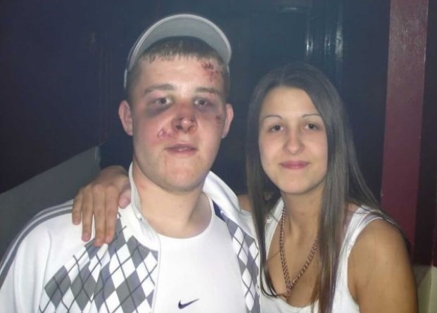 English Rednecks - Club Photos - been in a fight