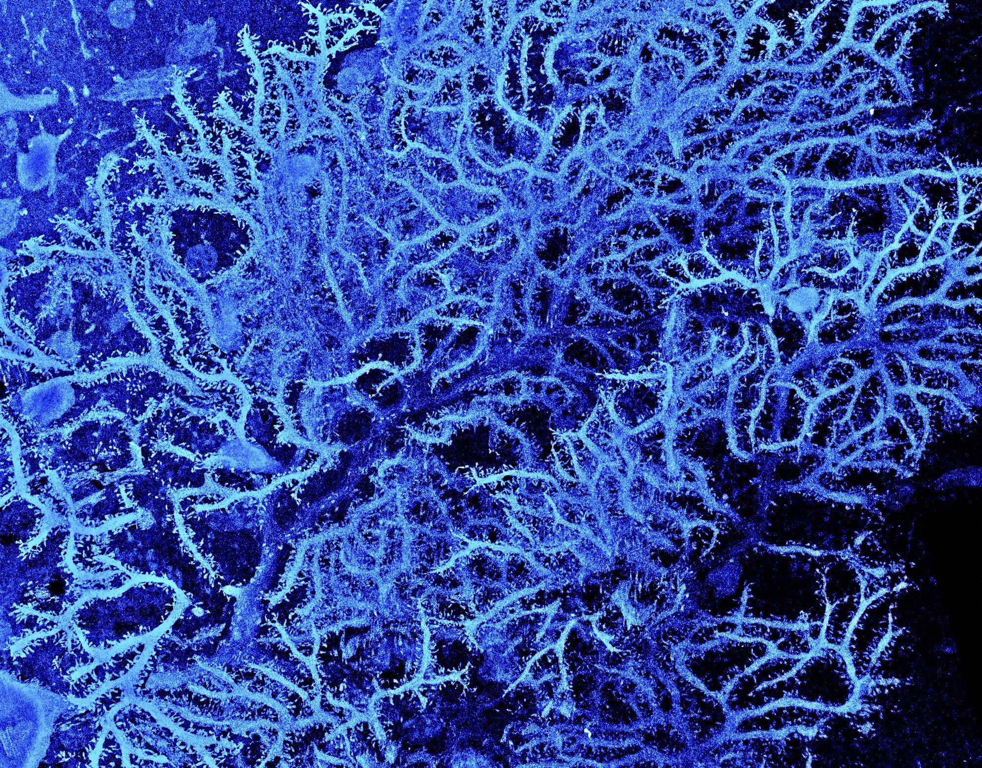 Things That Look Like Trees - Nerve Purkinje Fibres Electron Microscope