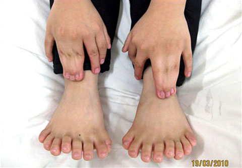 weird-china-31-fingers-toes